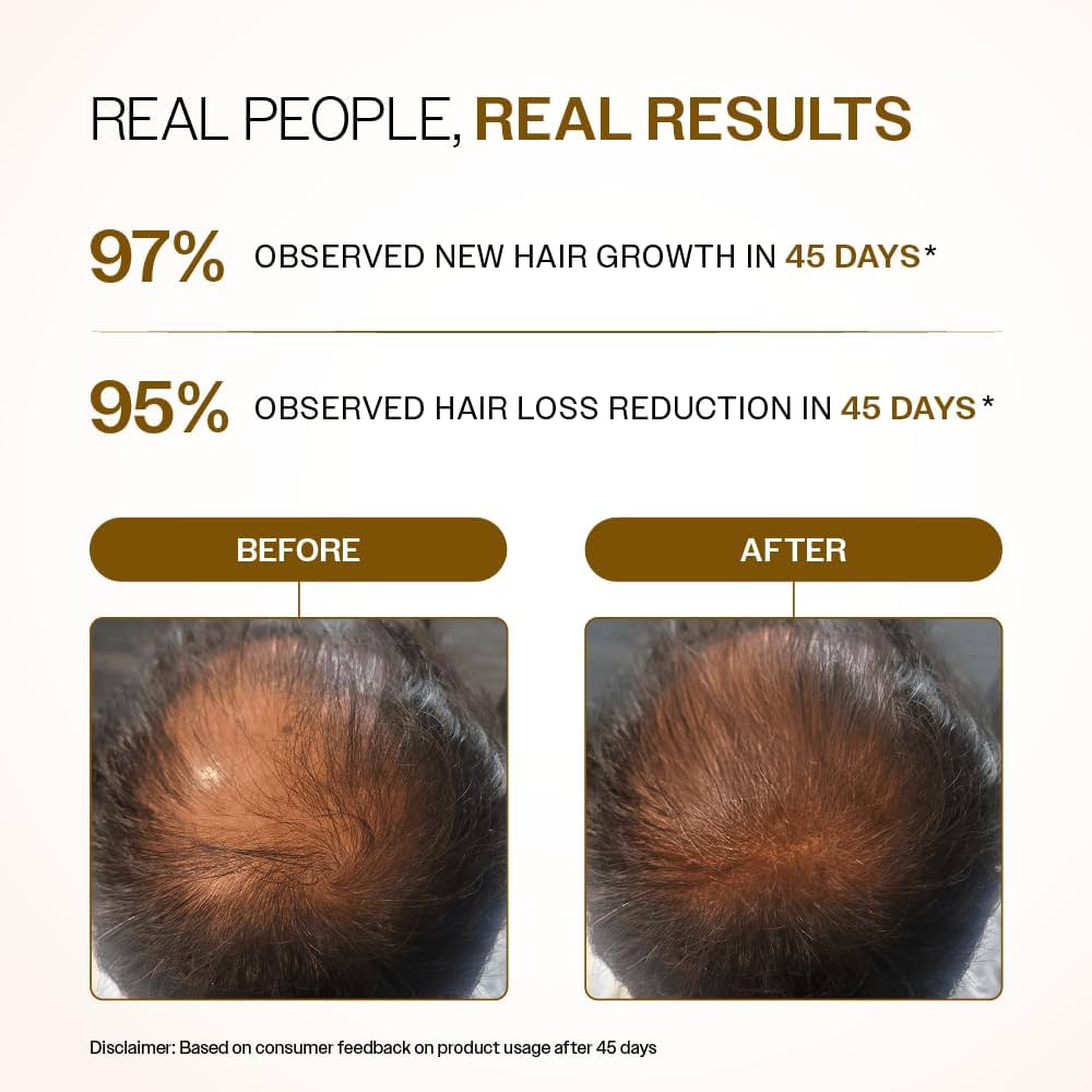 Bare Anatomy Advanced Hair Growth Serum