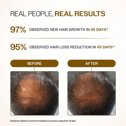 Bare Anatomy Advanced Hair Growth Serum