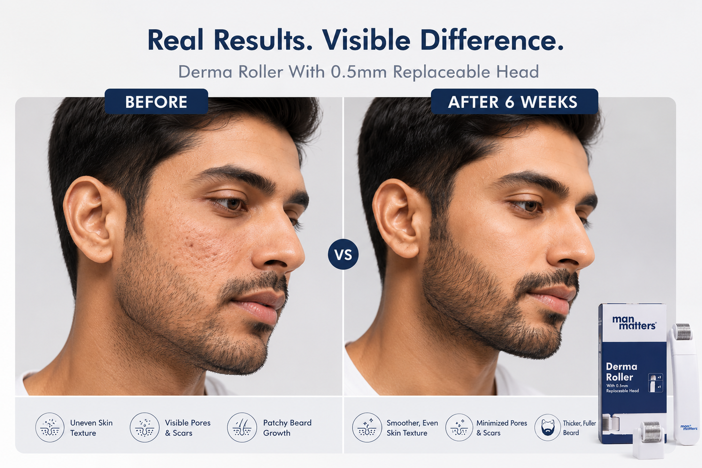 MAN MATTERS DERMA ROLLER